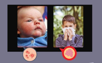 Když imunitní systém tančí na hraně